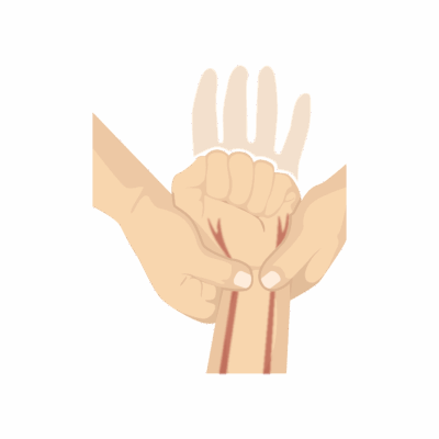 Allen's Test (Wrist)