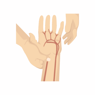 Allen's Test for the wrist